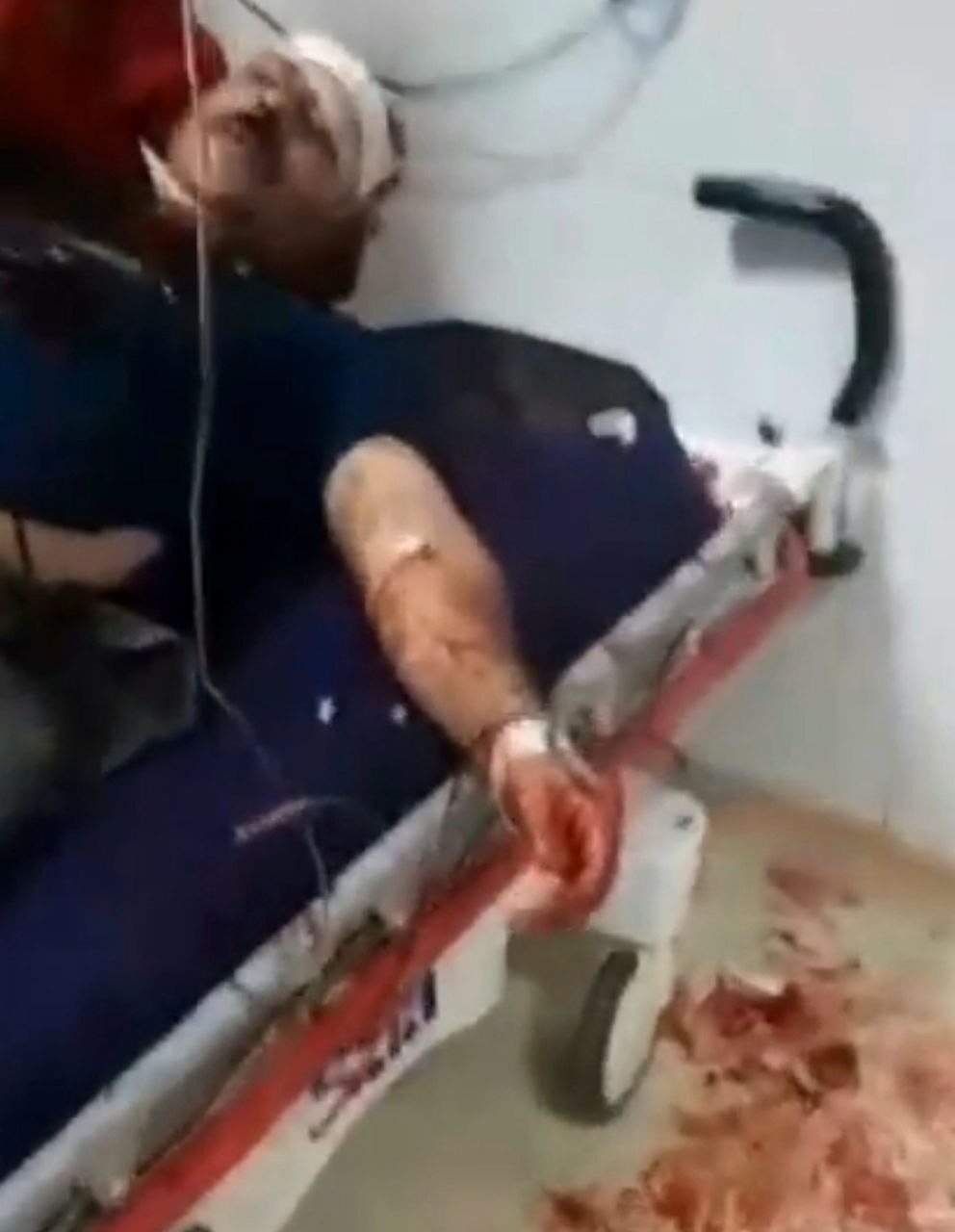 نزاع خونین با شمشیر در بیمارستان کوثر سنندج/ لزوم جلوگیری از درگیری در بیمارستان ها